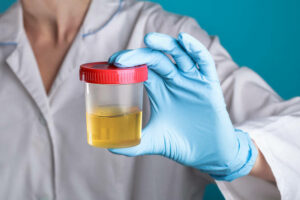 normative smaltimento urine Roma